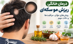 درمان خانگی ریزش مو سکه ای؛ روشهای مؤثر، مراقبتها و درمانهای علمی