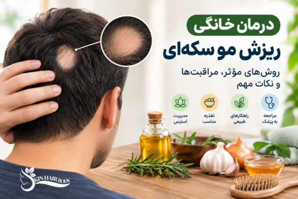 درمان خانگی ریزش مو سکه ای؛ روشهای مؤثر، مراقبتها و درمانهای علمی