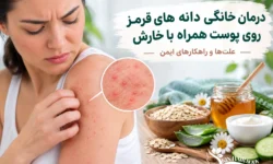درمان خانگی دانه های قرمز روی پوست همراه با خارش؛ علت‌ها و راهکارهای ایمن