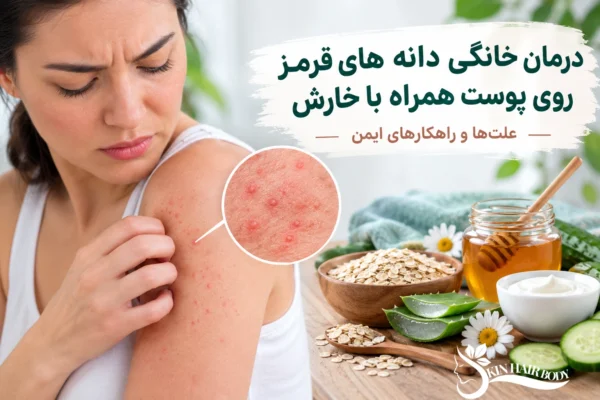 درمان خانگی دانه های قرمز روی پوست همراه با خارش؛ علت‌ها و راهکارهای ایمن