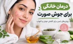 درمان خانگی برای جوش صورت؛ روش‌های ایمن و مؤثر