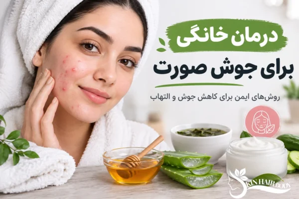 درمان خانگی برای جوش صورت؛ روش‌های ایمن و مؤثر